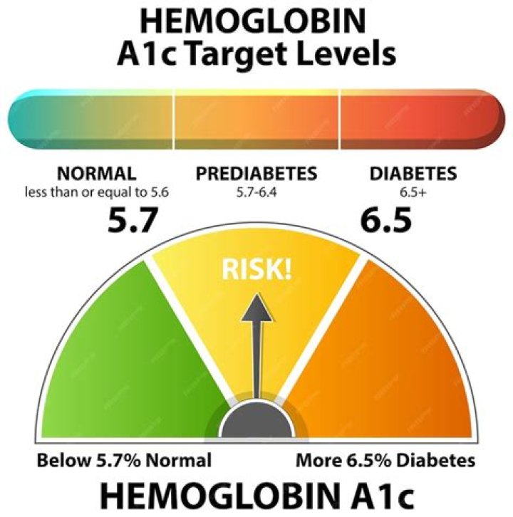Complete Guide To A1C Chart Ranges: Understanding Your Blood Sugar Levels