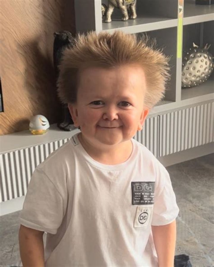 What's Hasbulla's True Age? Uncover The Facts