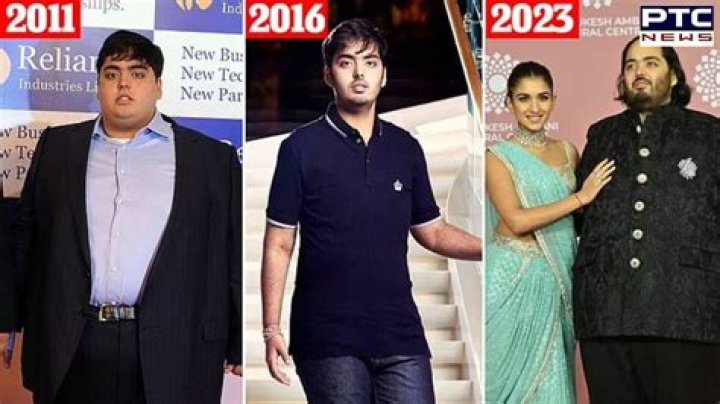 Uncovering Anant Ambani's Health Concerns: A Comprehensive Exploration
