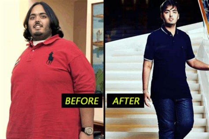 Anant Ambani's Health Journey: A Story Of Resilience And Recovery