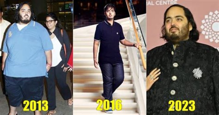 The Untold Truth About Anant Ambani's Health Condition