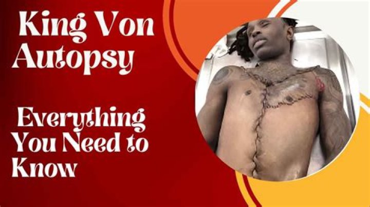 Suspicious Autopsy Results Of King Von Raise Questions