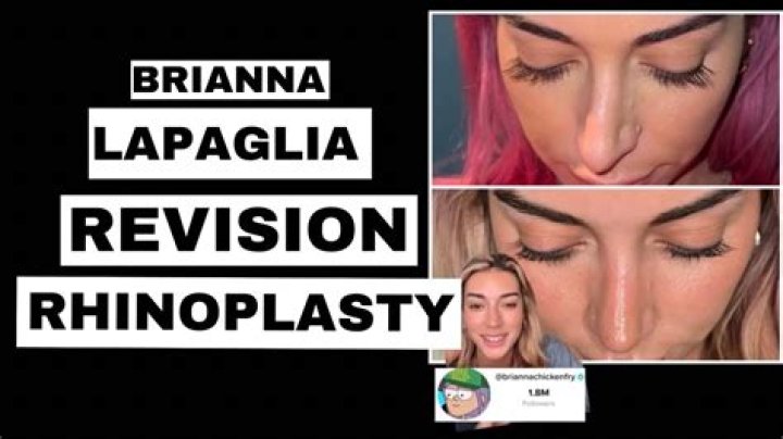 Uncover Brianna Lapaglia's Nose Job Journey: Secrets And Surprises Unveiled