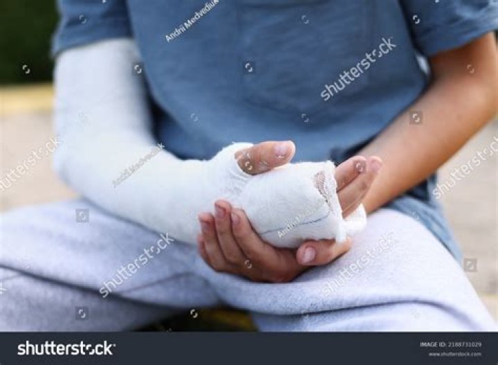 Visual Guide To Broken Hand Injuries