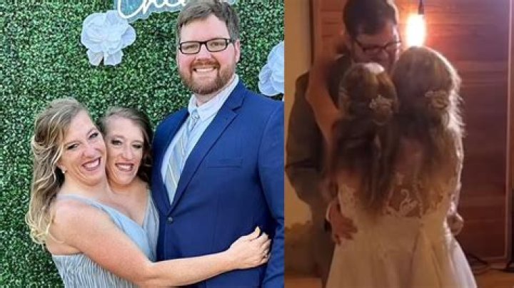 Conjoined Twins Abby And Brittany Hensel: Pregnancy And The Extraordinary Journey