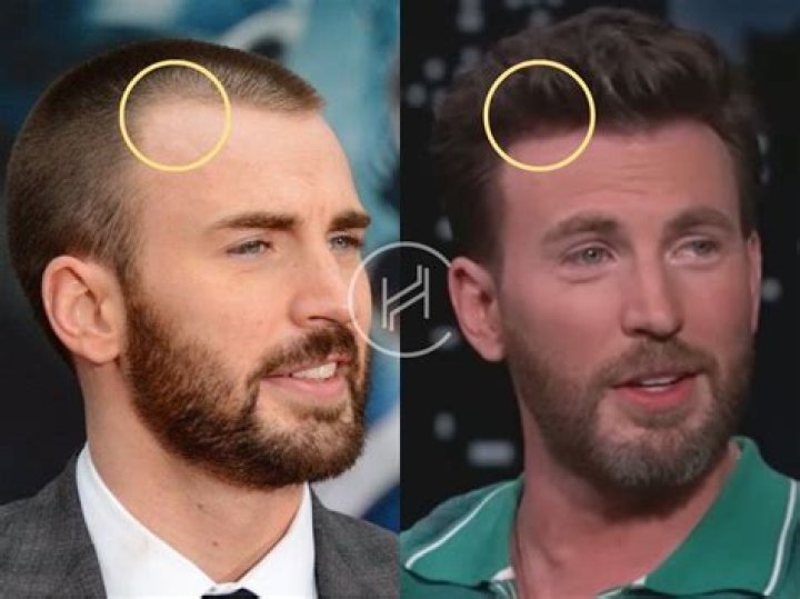 Unraveling The Mystery: Does Chris Evans Have An Oscar?