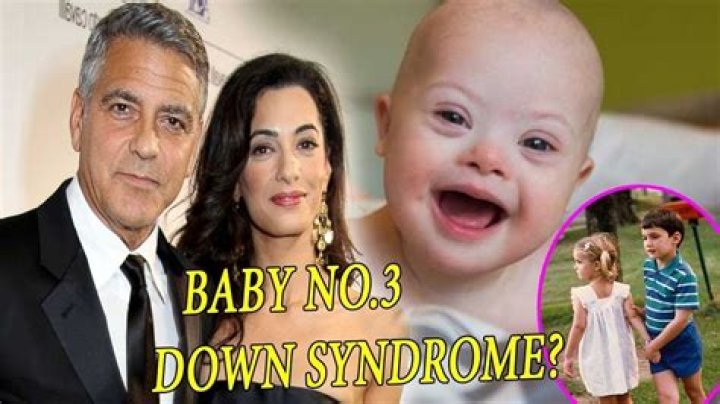 Celebrity Kids With Down Syndrome: The Truth About George Clooney's Son