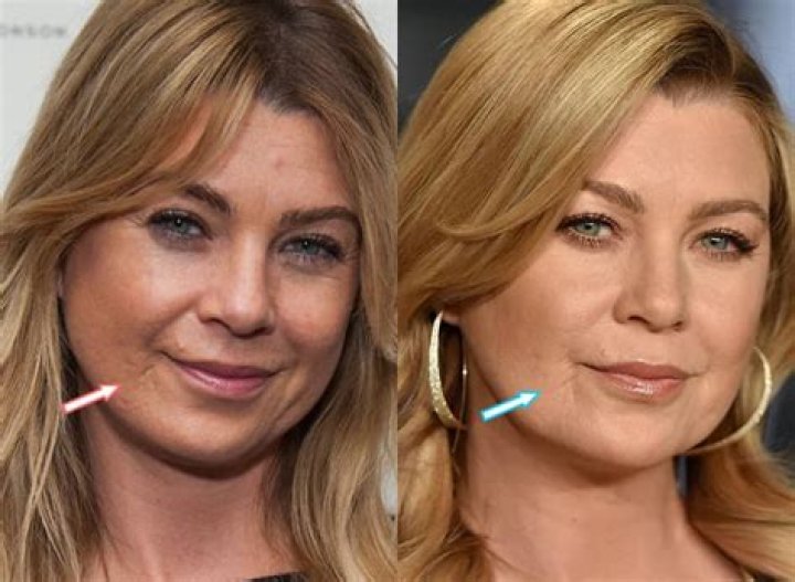The Ultimate Guide To Ellen Pompeo's Lip Filler Journey