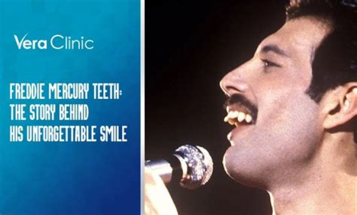 Freddie Mercury's Remarkable Teeth: A Unique Story Of Dental Distinction