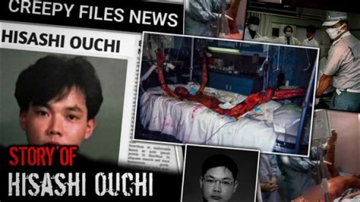 Hisachi Ouchi: The Tragic Story Of Japan's Radiation Victim