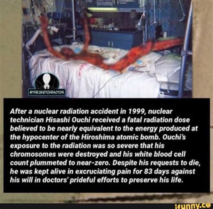 Hisashi Ouchi's Medical Journey: A Photographic Record Of Radiation's Devastating Effects