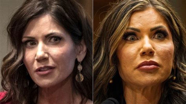 Plastic Surgery Speculations: Kristi Noem's Procedures Unveiled