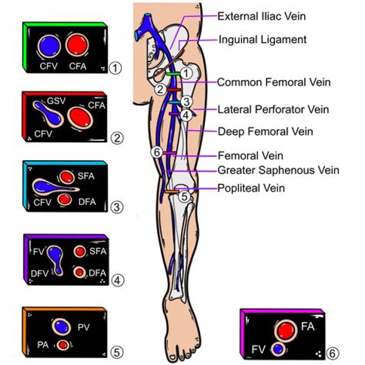 ICD 10 Code For Deep Vein Thrombosis: A Detailed Guide