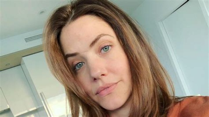 Julie Gonzalo's Iconic Scar: A Story Of Transformation And Beauty