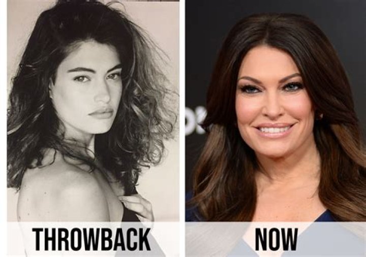 Kimberly Guilfoyle Transformation: Before And After