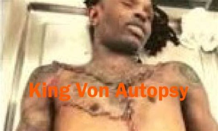 King Von Autopsy: The Revealing Truth