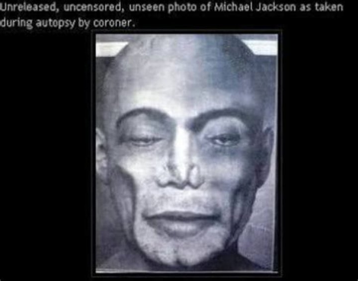 The Official Michael Jackson Autopsy Report: Uncovering The Truth