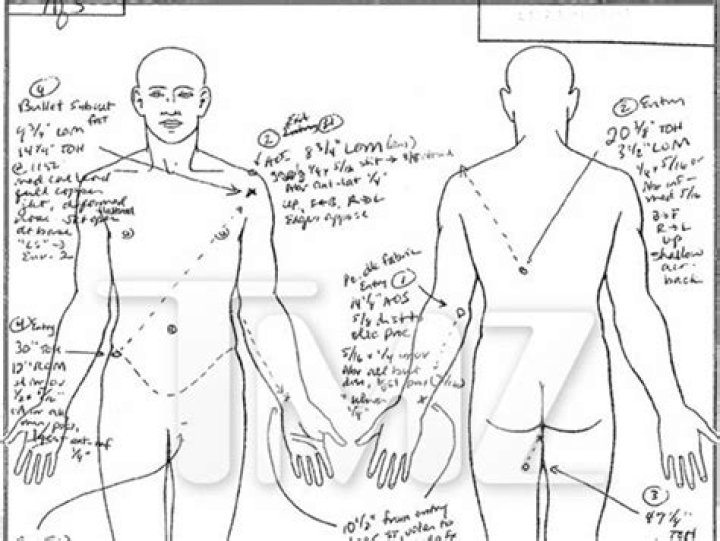 The Definitive Guide To Rappers Autopsy Reports And Findings