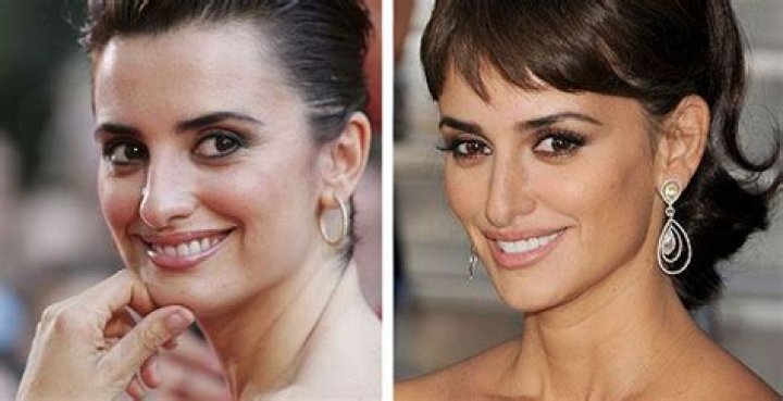 Rosemary Sanchez Surgery: Transformation Revealed