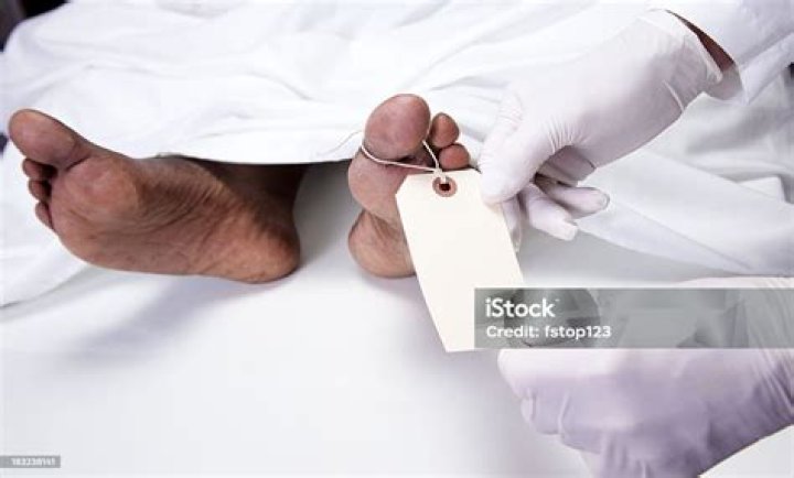 The Ultimate Guide To Von Autopsie: Everything You Need To Know