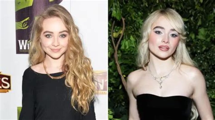 The Ultimate Guide To Sabrina Carpenter's Cosmetic Enhancements