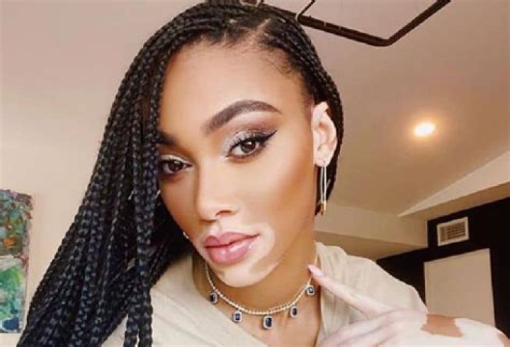 Winnie Harlow: Unveiling Her Unique Ethnicity